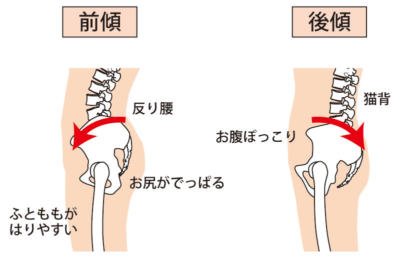 そもそも「反り腰」とはいったい？理想的な骨盤のバランスについて